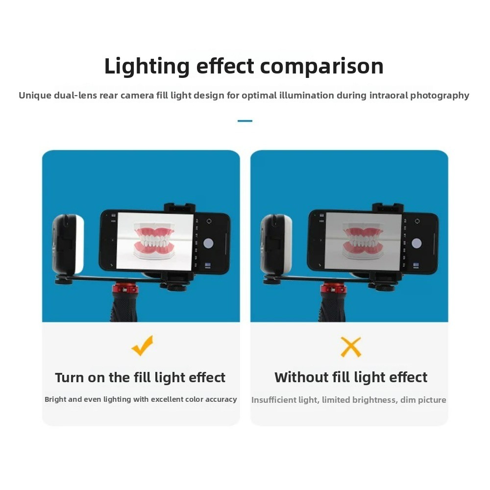 Dental Photography Light, Blue - đánh giá và giá Photography Lighting Kit Portable